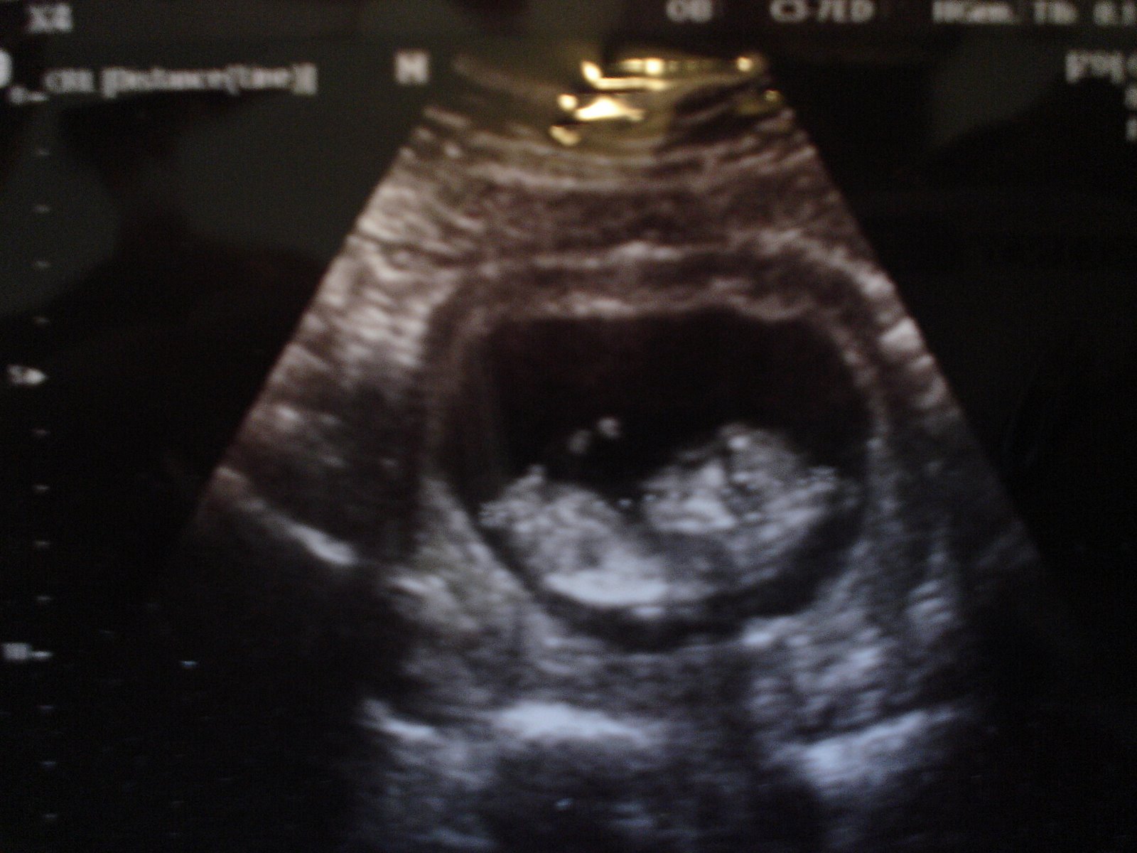 [baby+ultrasound+053.jpg]