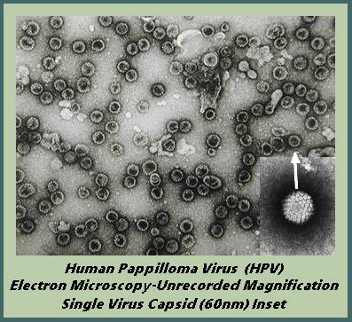 [HPV+Virus+Blog.jpg]