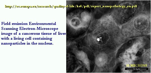 [liver_particle.JPG]