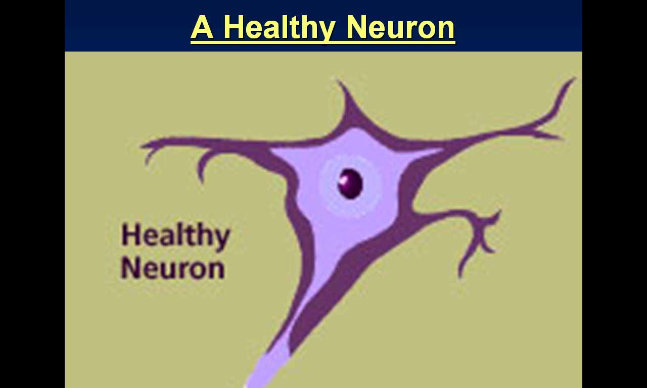 [7.+Healthy+Neuron.jpg]