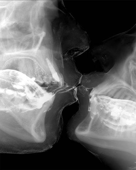 [x-ray-kiss.jpg]