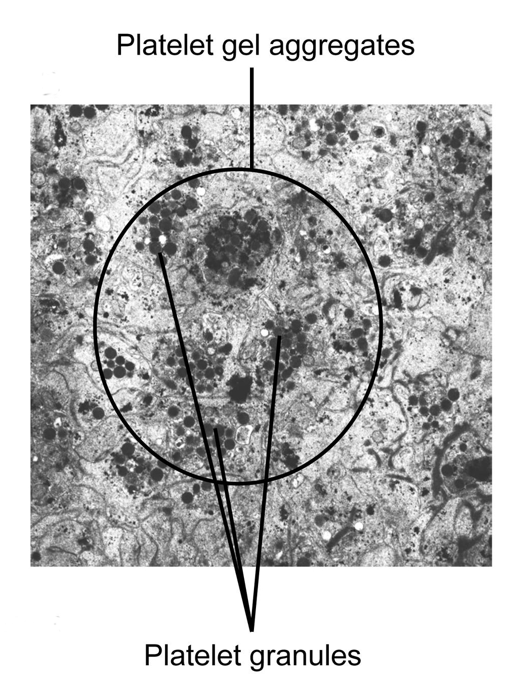 [PRP+Electron+Micrograph+Granules.jpg]