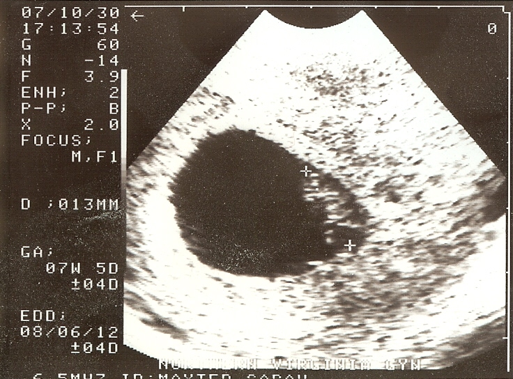 [first+ultrasound.jpg]