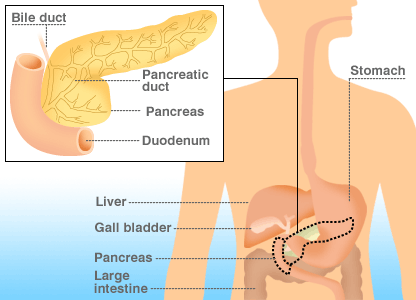[pancreatic+cancer.gif]