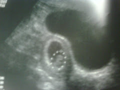 Baby Mowery's First Picture