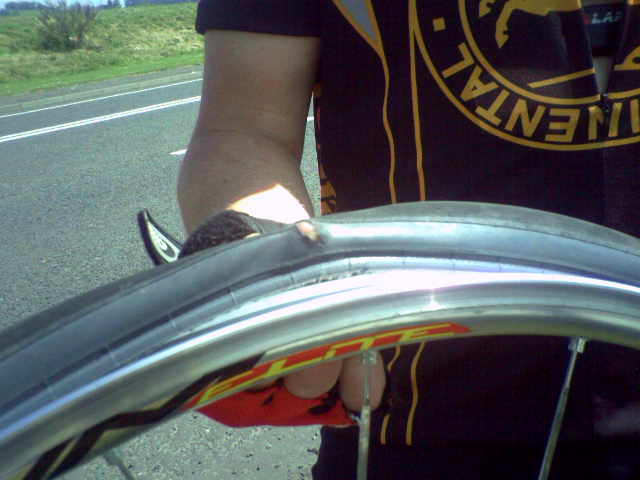 [Day+07a+Lee+Puncture.jpg]