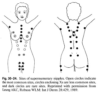 Nipples Sites
