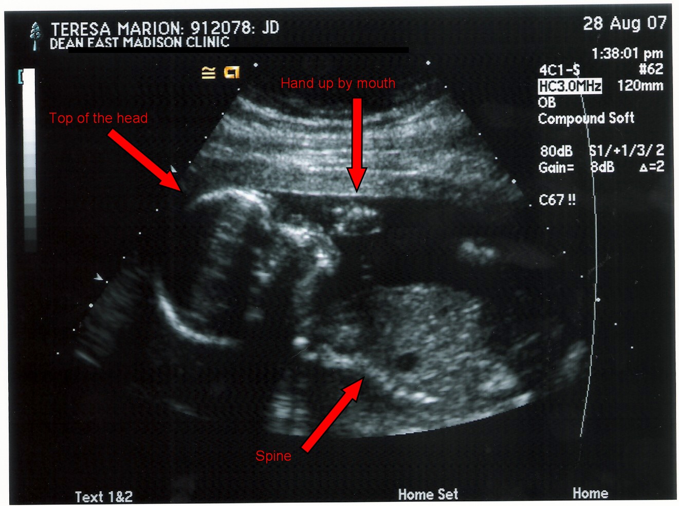 [Baby+Ultrasound+Pic+1.jpg]