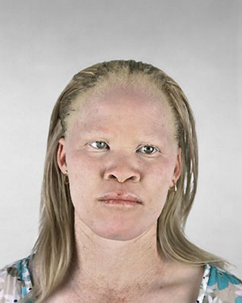 [albino-africans01.jpg]