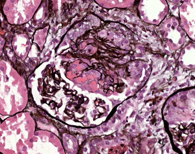 [silver+stain+glomerulus.bmp]