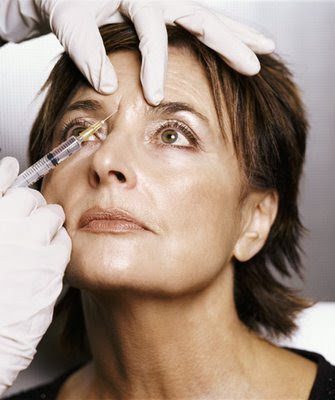 picture of a woman getting Botox